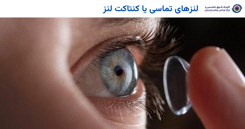 لنزهای تماسی یا کنتاکت لنز