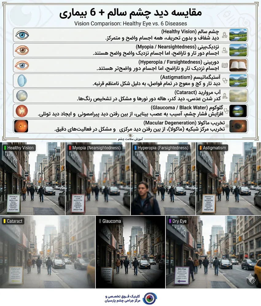 بیماریها و مشکلات رایج چشم
