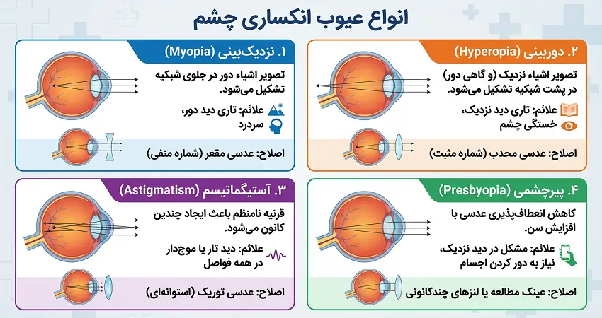 انواع عیوب انکساری چشم