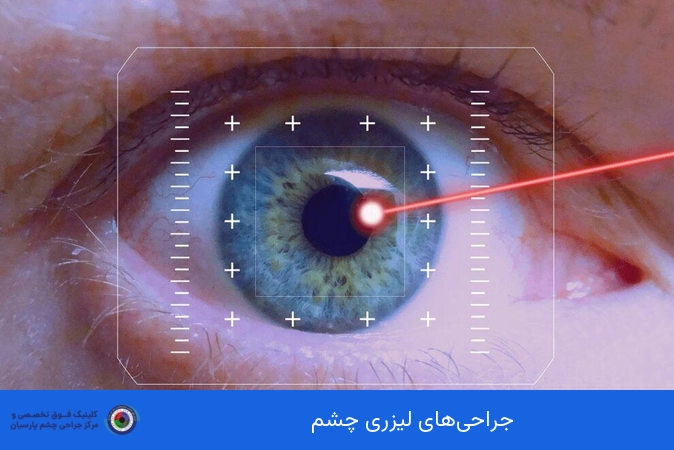 جراحی‌های لیزری چشم