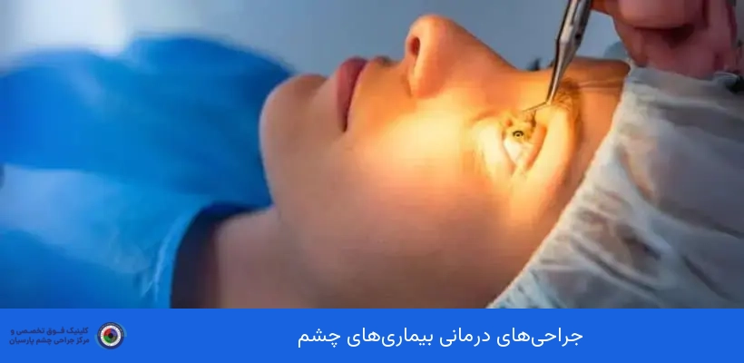 انواع جراحی‌های درمانی بیماری‌های چشم