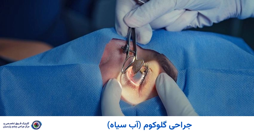 جراحی چشم گلوکوم (آب سیاه)