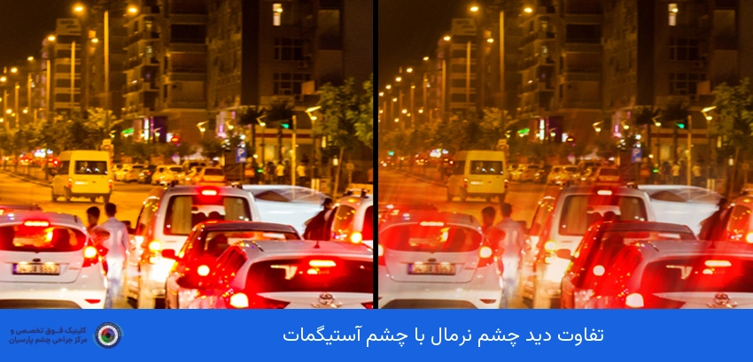 آستیگماتیسم چیست؟