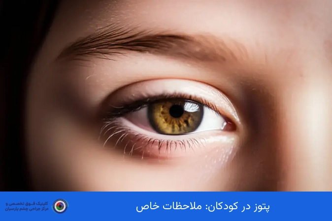 پتوز در کودکان: ملاحظات خاص
