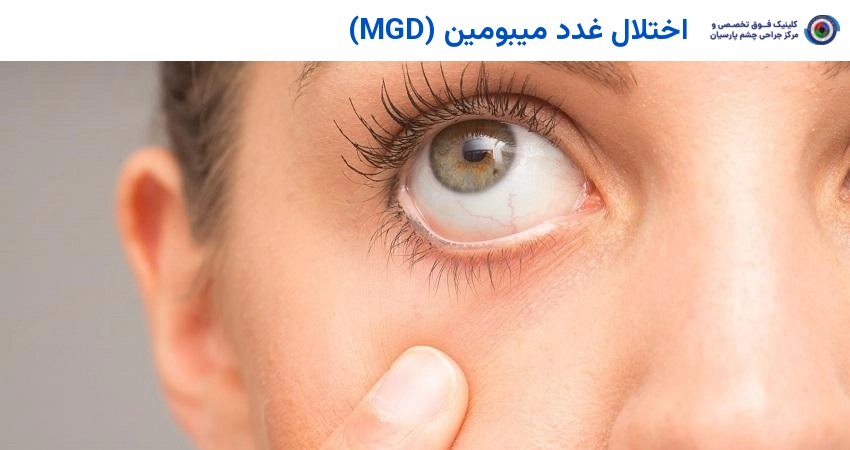 غدد میبومین