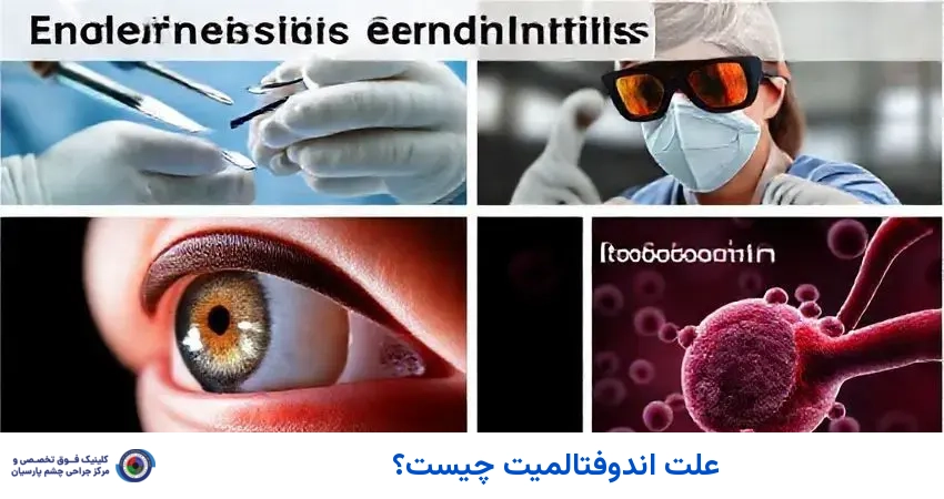 علت اندوفتالمیت چیست؟