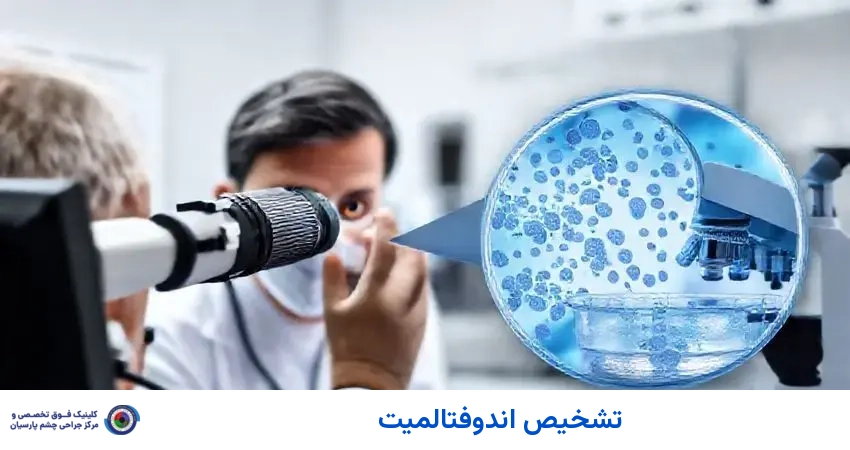 تشخیص اندوفتالمیت