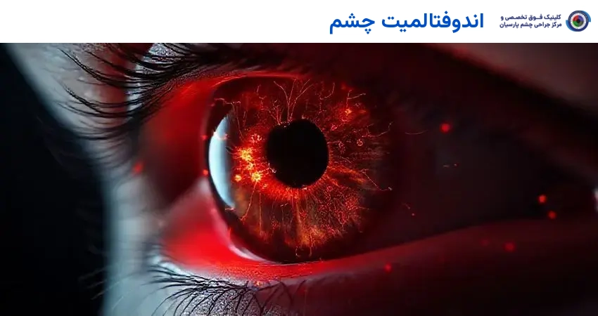 اندوفتالمیت چشم