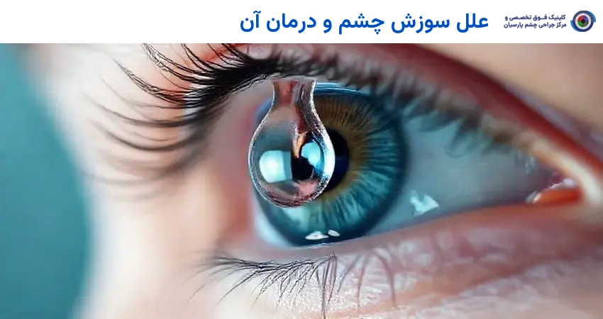 علل سوزش چشم و درمان آن