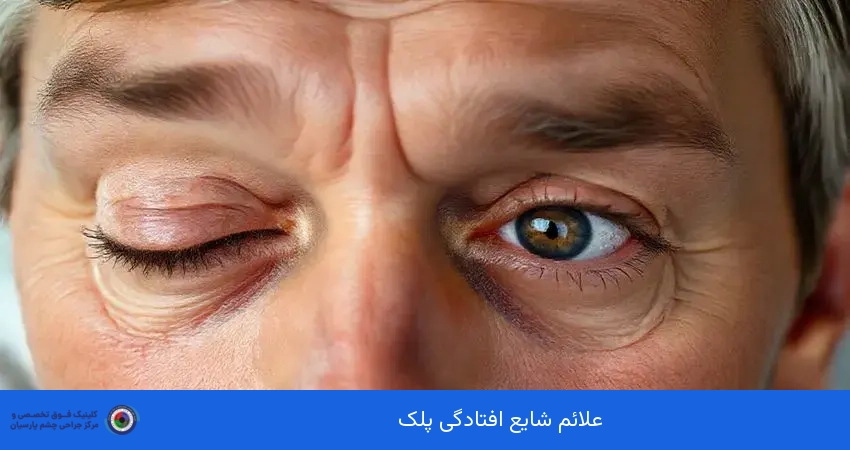 علائم شایع افتادگی پلک
