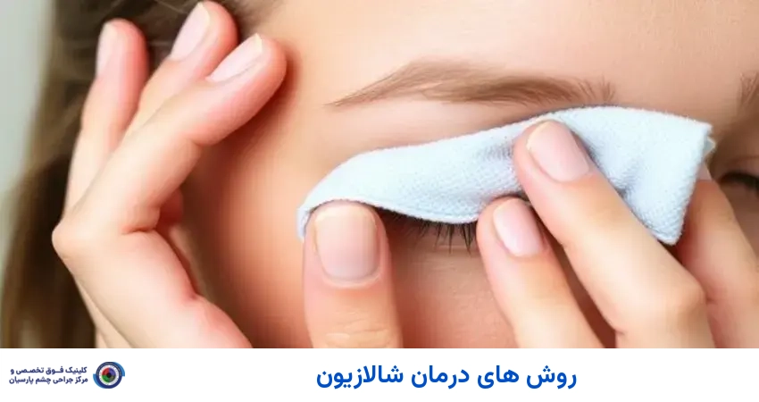 روش های درمان شالازیون