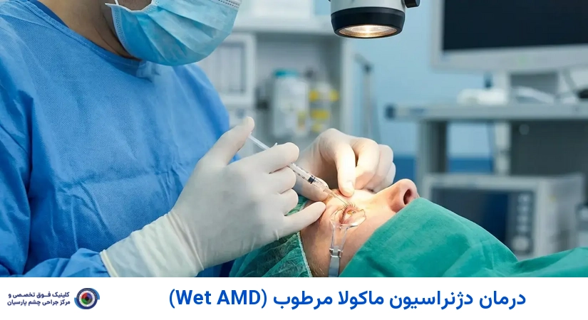 درمان دژنراسیون ماکولا مرطوب (Wet AMD)