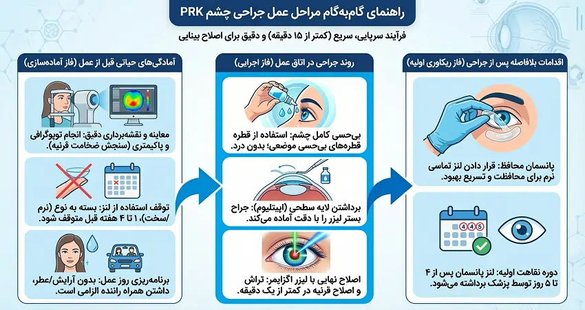 مراحل جراحی prk