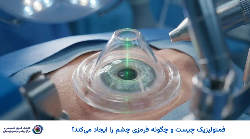 فمتولیزیک چیست و چگونه قرمزی چشم را ایجاد میکند؟