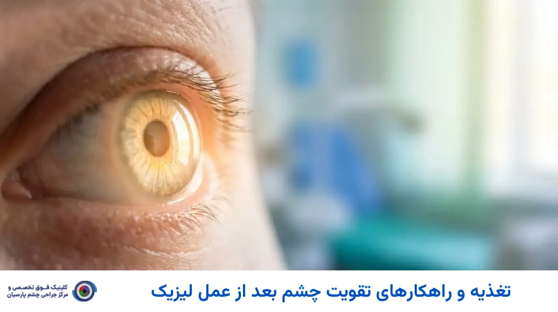 تغذیه و راهکارهای تقویت چشم بعد از عمل لیزیک