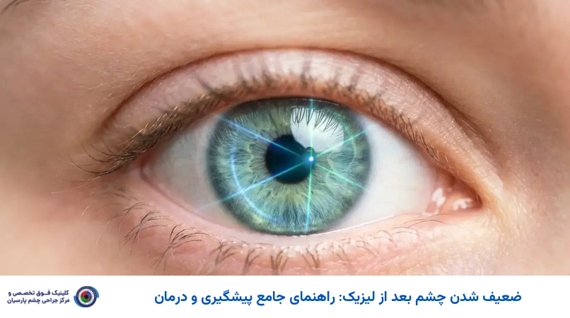 ضعیف شدن چشم بعد از لیزیک: راهنمای جامع پیشگیری و درمان