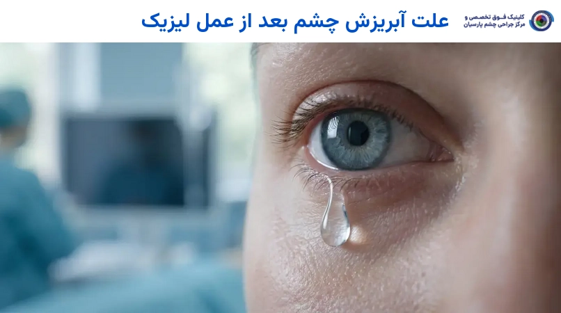 علت آبریزش چشم بعد از عمل لیزیک